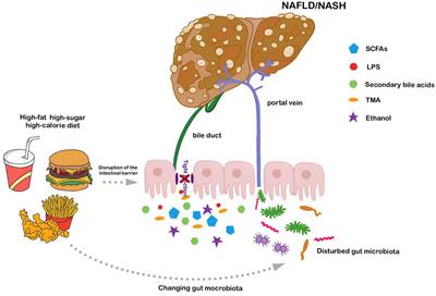 Gut microbe and hepatic macrophage polarization in non-alcoholic fatty liver disease